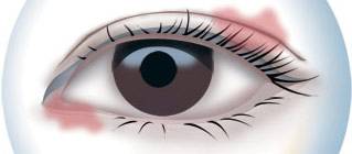 CBA***得分手發高燒吸氧0得分 教練：賓館房間新裝修，甲醛中毒導致的！