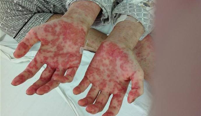 室內(nèi)甲醛檢測治理，你不得不需要了解的三點！