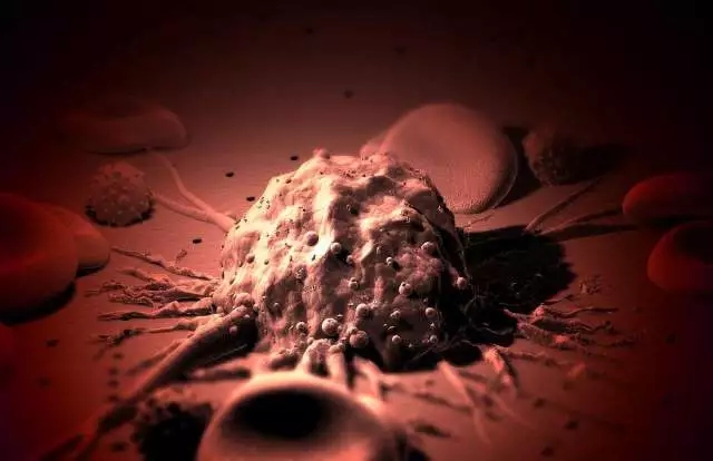 癌癥、白血病越來(lái)越多，是因?yàn)闀r(shí)代在進(jìn)步而導(dǎo)致的嗎？